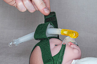 Layer A - 4. Befestigen der Beatmungsschläuche